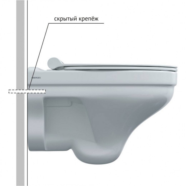  BERGES   ALBIT S Rimless 52   Top Slim SO,   082147